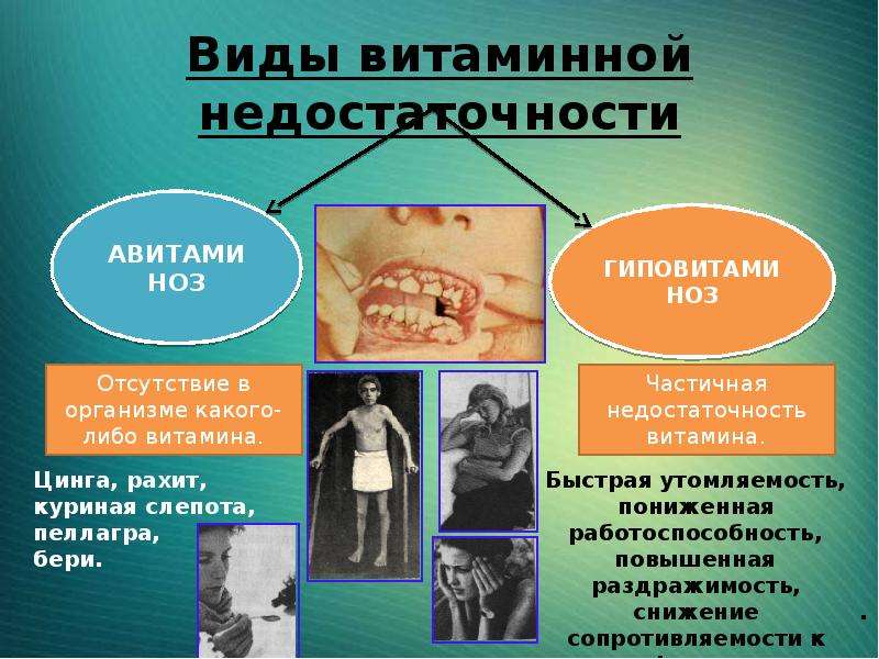 Оптимальные пути профилактики витаминной недостаточности. Формы витаминной недостаточности. Виды витаминной недостаточности. Виды недостаточности витаминов. Понятие витаминной недостаточности.