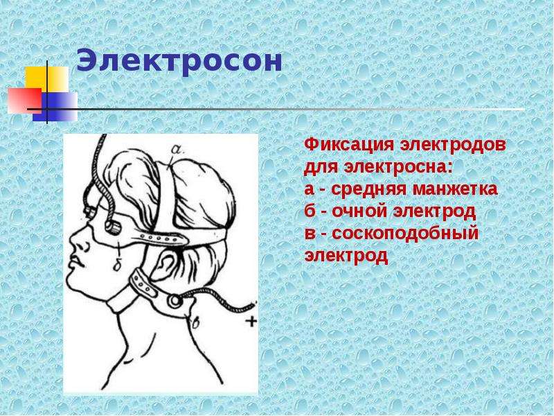 Электросон. Электросон методы. Методика процедуры электросна. Механизм лечебного действия электросна.