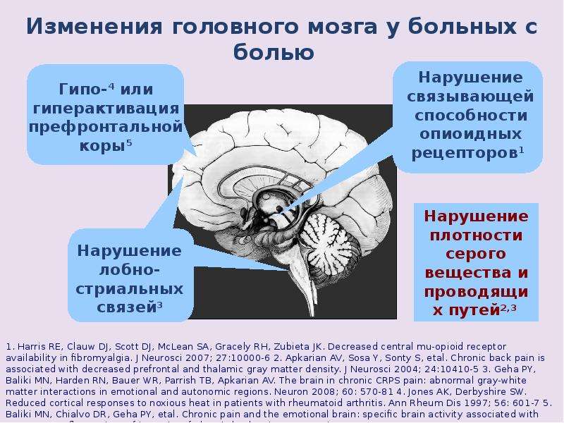 Презентация на тему боль