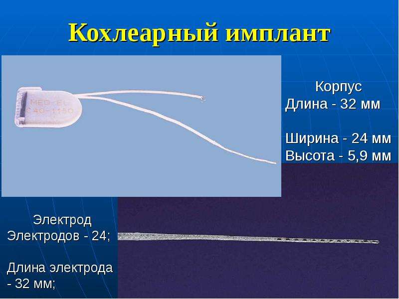 Кохлеарная имплантация презентация