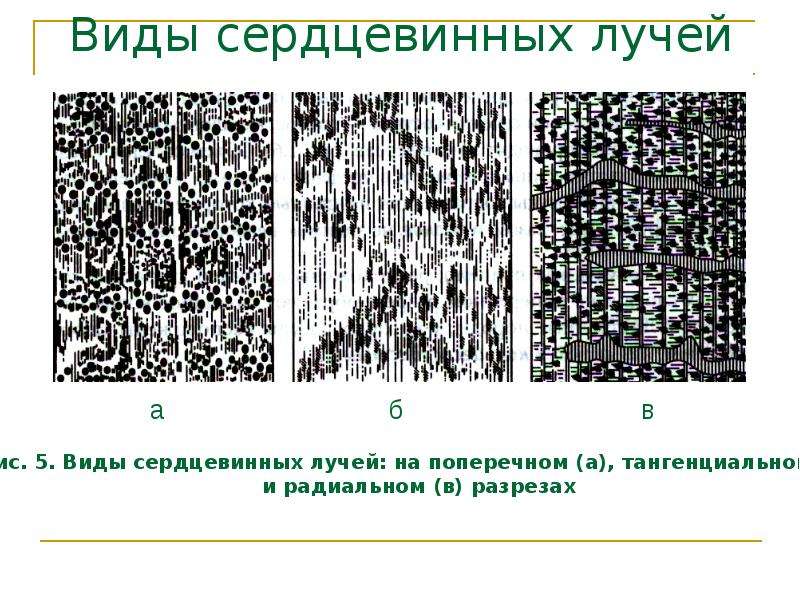 Сердцевинные лучи древесины. Виды сердцевинных лучей. Сердцевидные лучи древесины это. Сердцевинные лучи на радиальном разрезе.
