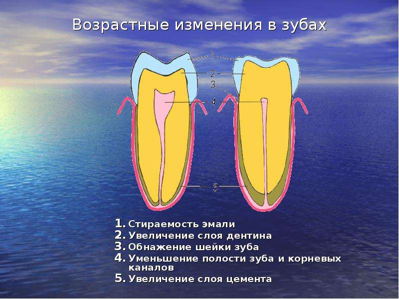 Возрастные изменения в зубах Стираемость эмали Увеличение слоя дентина Обнажение шейки зуба Уменьшен