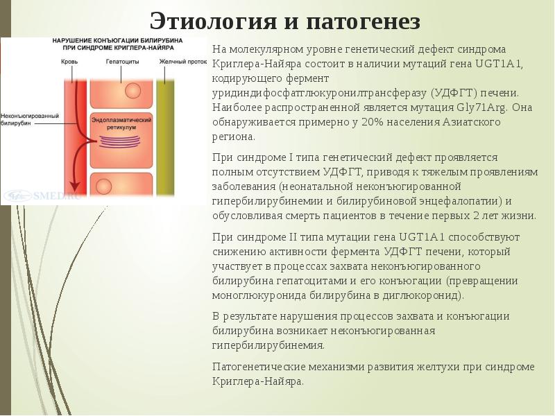 Синдром криглера найяра презентация