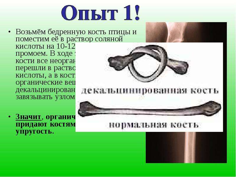 Что значит кости. Опыт декальцинированная кость. Нормальная и декальцинированная кость.