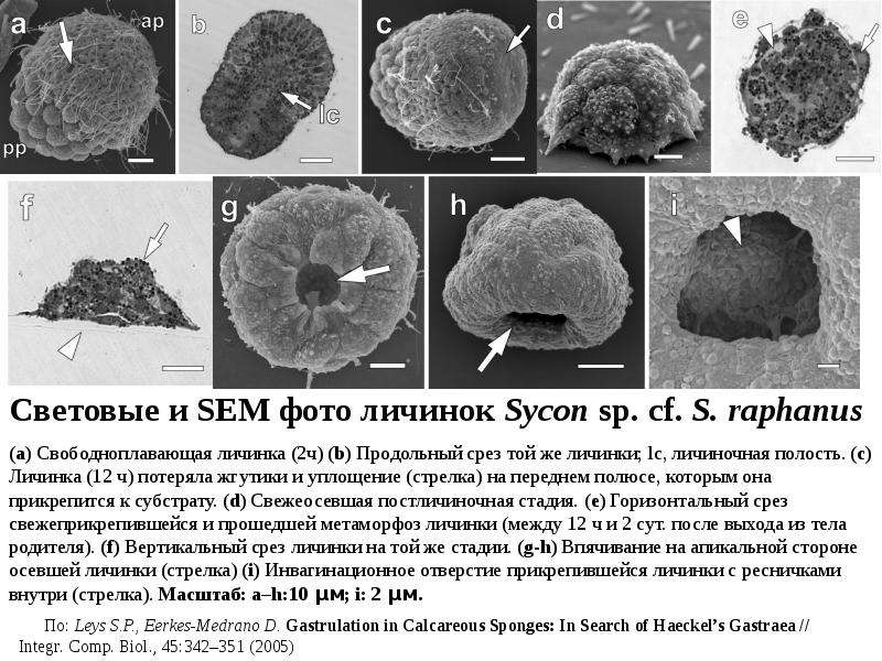 Низший 6. Sycon поперечный срез. Sycon Raphanus строение. Свободноплавающая личинка стадия. Характеристика свободноплавающей личинки.