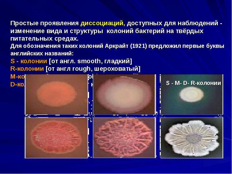 Виды колоний. Колонии s и r формы. R форма колоний бактерий. R S колонии бактерий. Структура колоний бактерий.