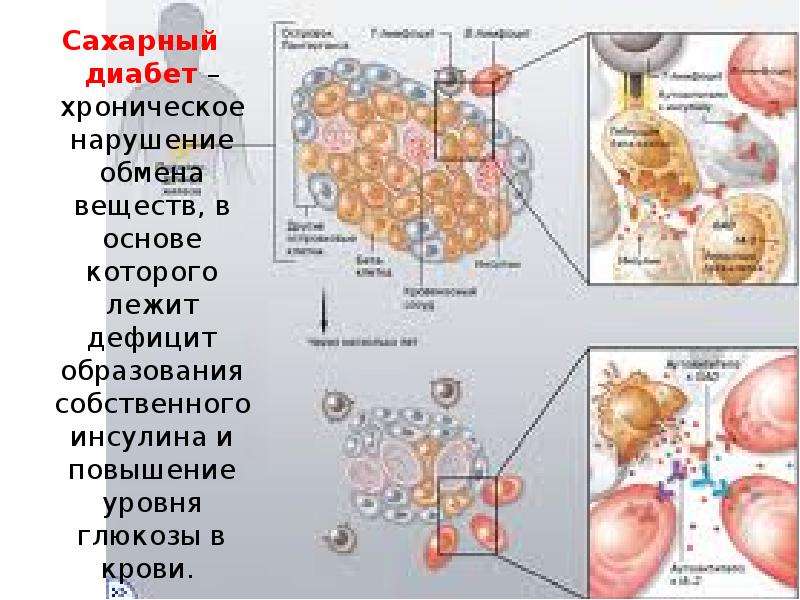 Презентация сахарный диабет биохимия