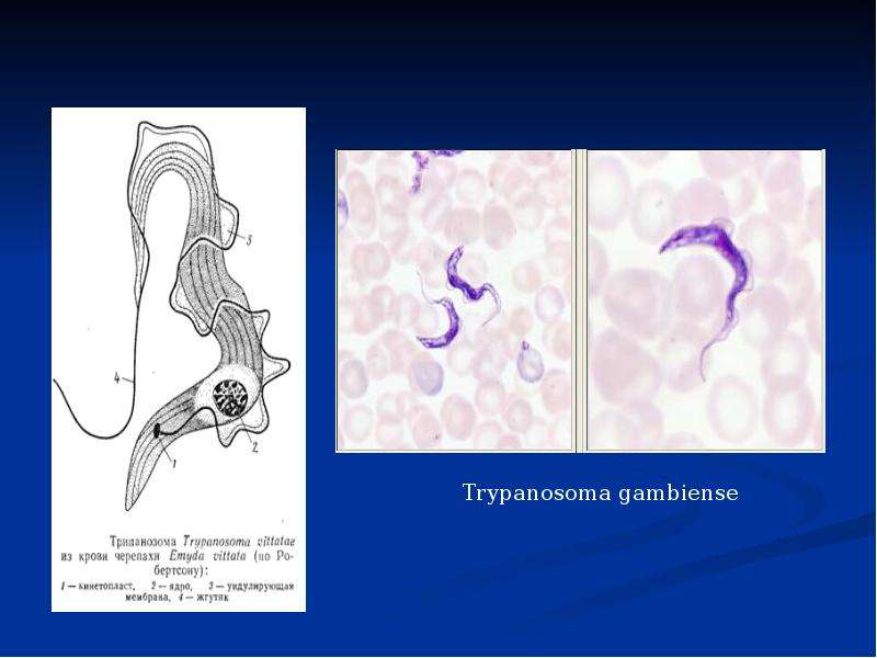 Строение трипаносомы рисунок с подписями