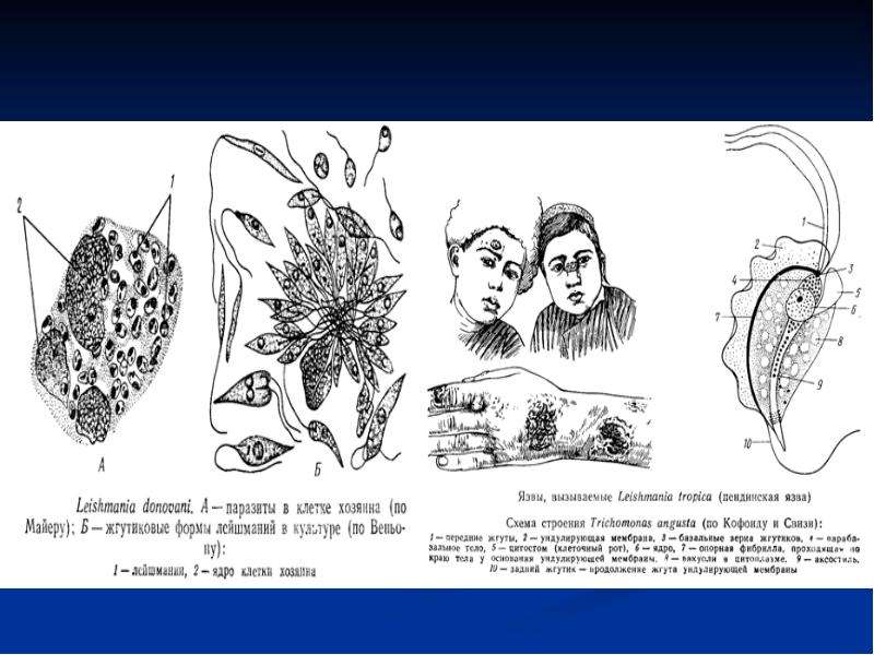 Лейшмания строение рисунок