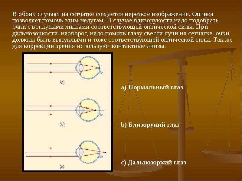 Резкое изображение предмета в нормальном глазе создается