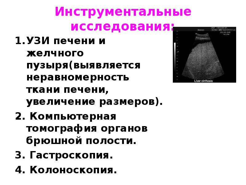 Узи брюшной полости цирроз печени. Ультразвуковое обследование печени желчного пузыря. Инструментальные исследования печени и желчного пузыря. УЗИ брюшной полости печени и желчного пузыря. Подготовка к УЗИ печени и желчного пузыря.