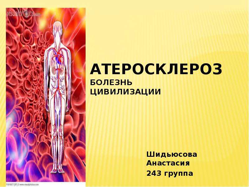 Болезни цивилизации. Атеросклероз болезнь цивилизации. Атеросклероз презентация. Атеросклероз презентаци. Презентация на тему атеросклероз.