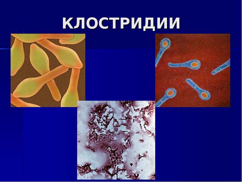 Клостридии это. Клостридии классификация микробиология. Морфология бактерий презентация. Клостридии бактерии. Клостридии расположение.