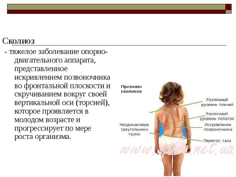 Проект по биологии сколиоз 9 класс