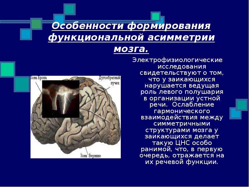 Функциональная асимметрия. Межполушарная асимметрия коры головного мозга. История изучения функциональной асимметрии мозга. Межполушарная асимметрия мозга таблица. Особенности формирования функциональной асимметрии мозга..