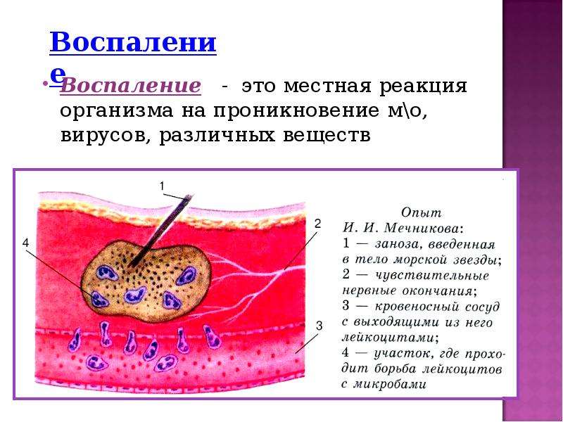 Воспаление картинки для презентации