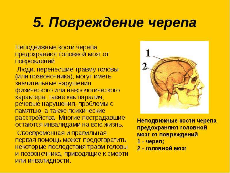 Травмы черепа и головного мозга. Неподвижные кости черепа. Разрыв черепной коробки.