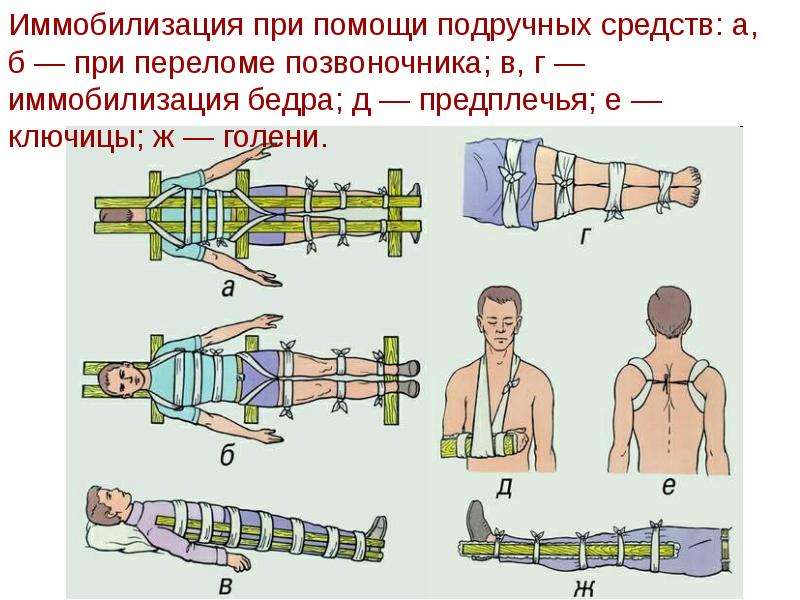 Травмы головы позвоночника и спины обж 9 класс презентация