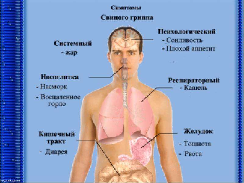 Свиной грипп. Симптомы гриппа свиной грипп. Свиной грипп презентация.