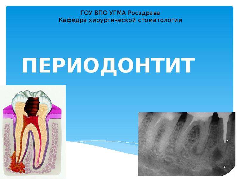 Физиотерапия при периодонтите презентация