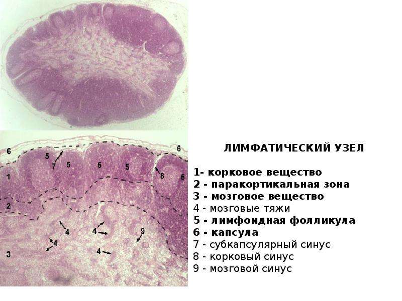 Лимфоузел гистология рисунок