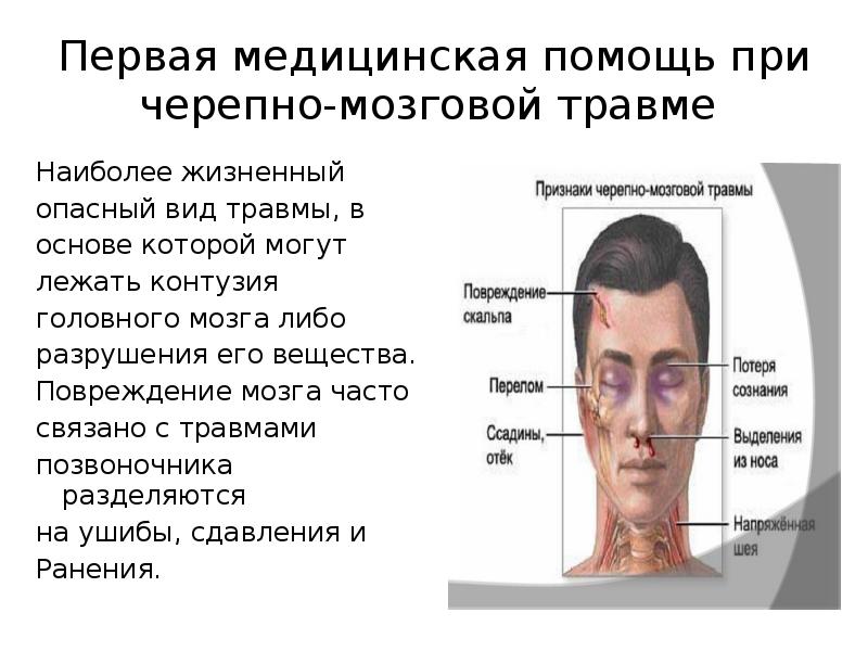 Пмп при чмт презентация