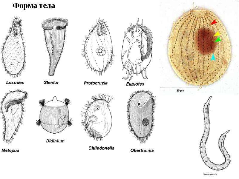 3 формы организмов. Форма тела простейших. Форма тела ресничных. Грушевидная форма тела у простейших. Infusoria форма тела.