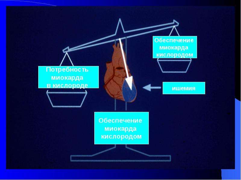 Острого коронарного синдром презентация скачать бесплатно