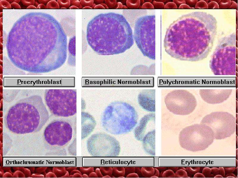 Нормобласты в крови картинки
