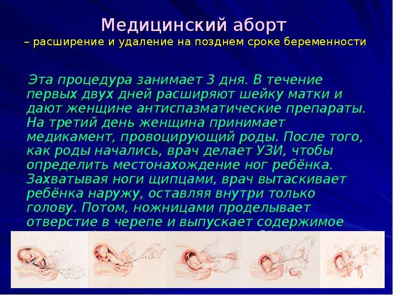 До какого срока можно сделать. Борт. Медицинское прерывание беременности. Хирургический медицинский аборт. Аборты медицинские презентация.