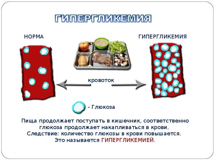 Гипергликемия это. Сахарный диабет у детей гипергликемия. Сахарный диабет 1 типа гипергликемия. Гипергликемия при сахарном диабете 2 типа симптомы. Гипергликемия при сахарном диабете 1 типа у детей.