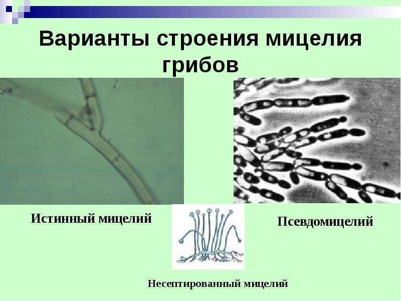 Обнаружены споры и мицелий. Мицелий грибов микробиология. Мицелий и псевдомицелий. Мицелий и псевдомицелий грибов.