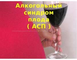 Алкогольный синдром плода ( АСП )