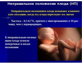 Неправильное положение плода (НП)