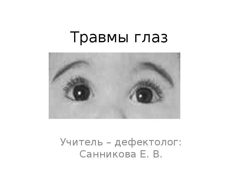 Заболевание и повреждение глаз биология 8 класс. Травмы глаза презентация. Глаза учителя. Травмы глаз 8 класс биология. Травмы глаз на производстве.