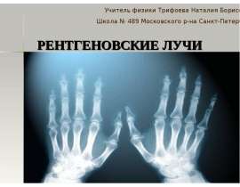 Рентгеновские лучи