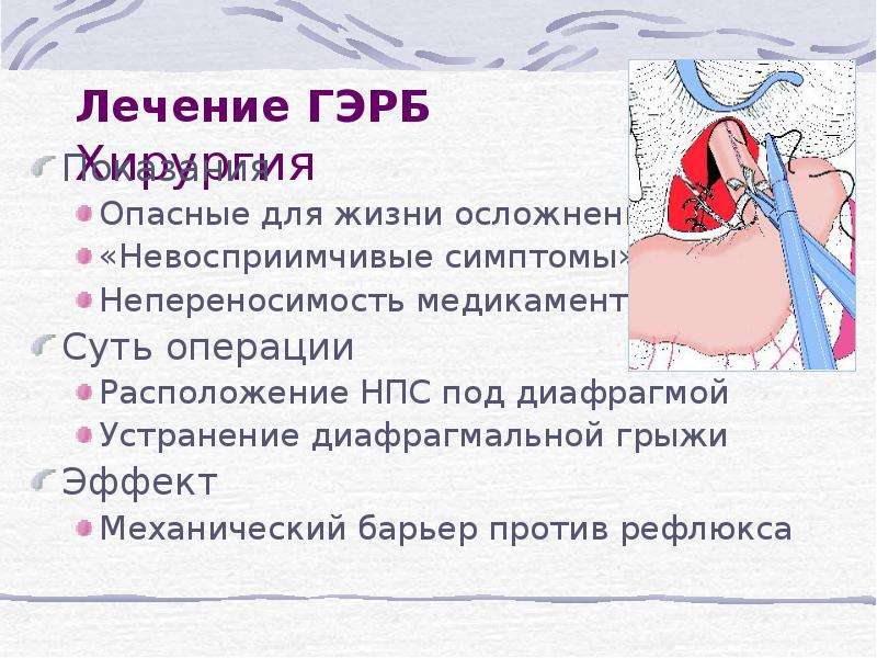 Гастроэзофагеальная рефлюксная болезнь презентация