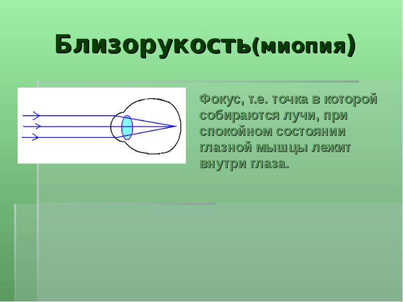 Глаз и зрение близорукость и дальнозоркость очки 8 класс презентация