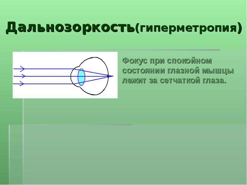 Близорукость и дальнозоркость физика презентация