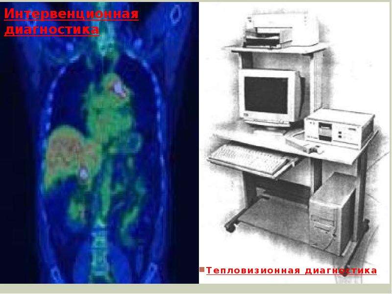 Ядерная физика в медицине презентация