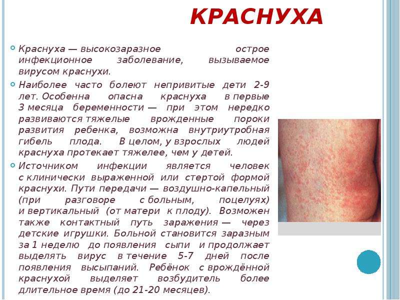 Детские инфекции презентация