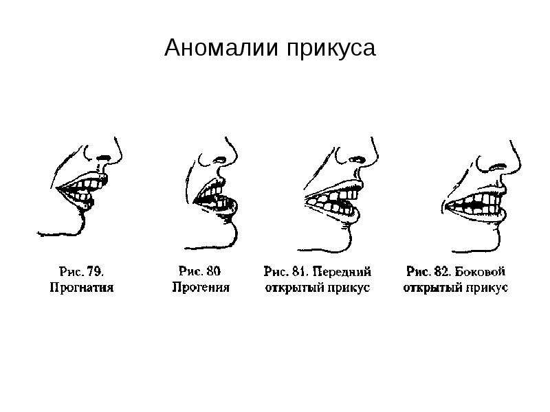 Патологии органов речи схема