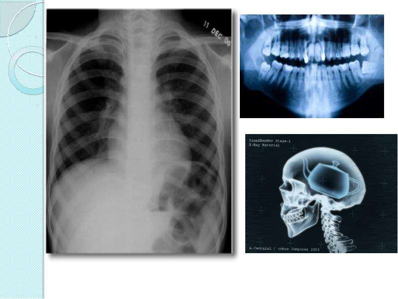Рентгеновское излучение фото для презентации