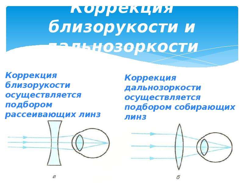 Презентация глаз очки