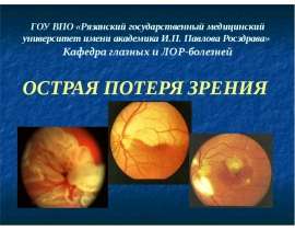 Острая потеря зрения