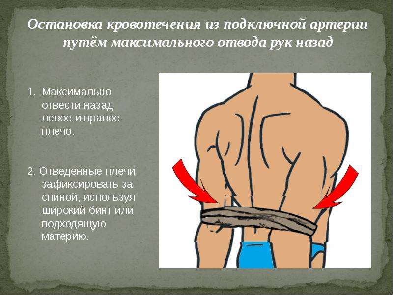 Первая помощь при ранениях обж 11 класс презентация