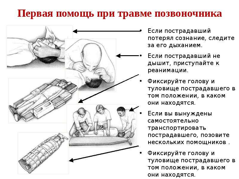 Первая помощь при ранении головы. Признаки и симптомы травм головы и позвоночника ОБЖ. Сообщение на тему травмы головы позвоночника и спины. Первая помощь при травмах головы и позвоночника ОБЖ. Травмы головы презентация.