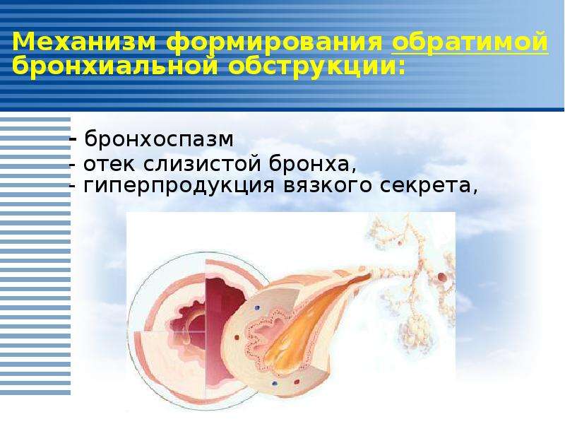 Бронхоспазм. Механизм развития бронхоспазма. Механизмы формирования бронхиальной обструкции. Бронхоспазм презентация. Синдром бронхоспазма.