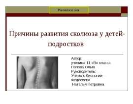 Причины развития сколиоза у детей-подростков