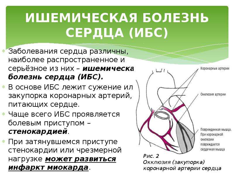 Презентация на тему ишемическая болезнь сердца